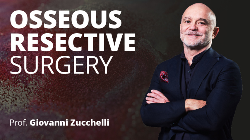 Osseous Resective Surgery course thumbnail